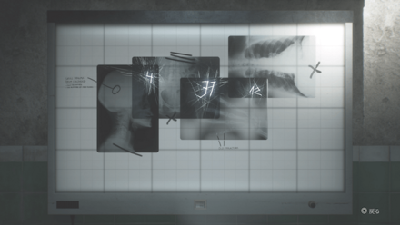 レントゲンのパズル