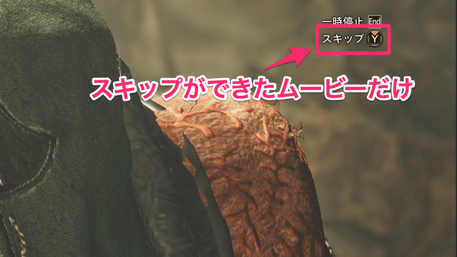 スキップ可能のみ