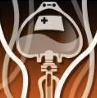 創傷置換の画像