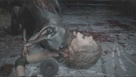 ゾンビ犬に噛まれて死亡