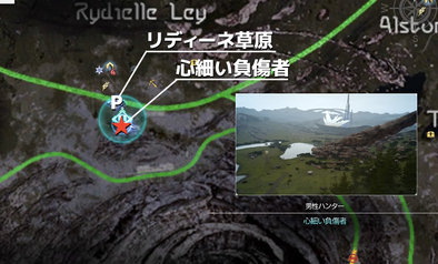 心細い負傷者の受注場所