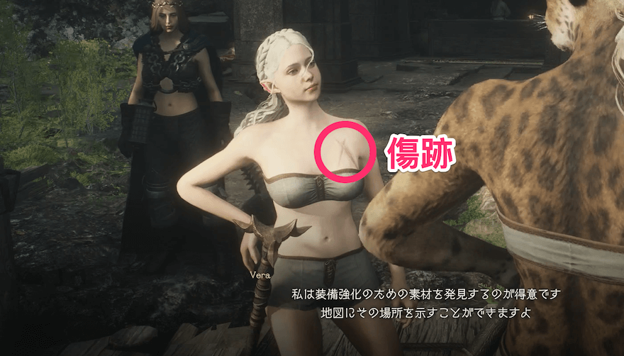 傷跡（入浴前）